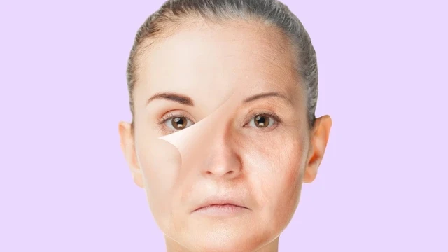 bai-viet/lieu-trinh-tre-hoa-da-mat-gia-bao-nhieu-co-nhung-phuong-phap-tre-hoa-da-nao.html