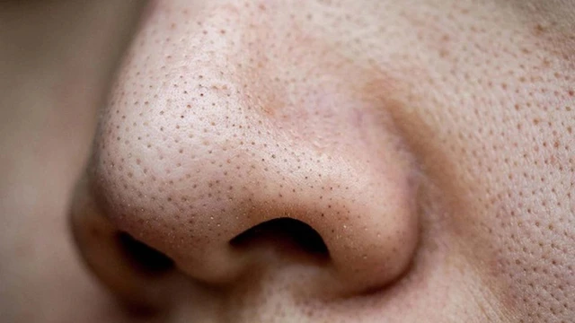 bai-viet/lo-chan-long-den-la-gi-nguyen-nhan-va-cach-phong-tranh.html