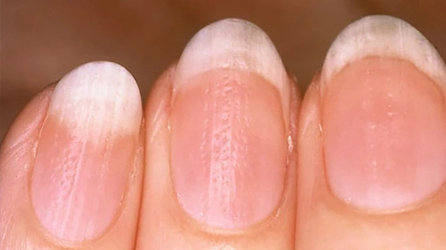 bai-viet/loan-duong-mong-va-nhung-dieu-can-biet.html