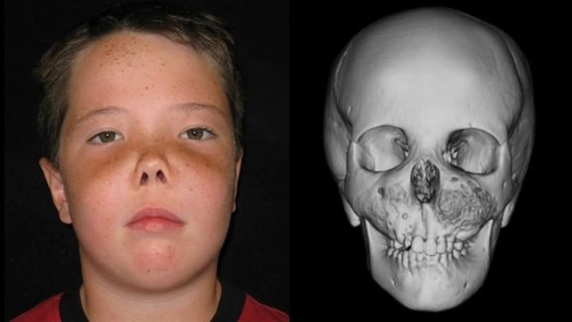 bai-viet/loan-san-soi-xuong-nguyen-nhan-trieu-chung-va-dieu-tri.html