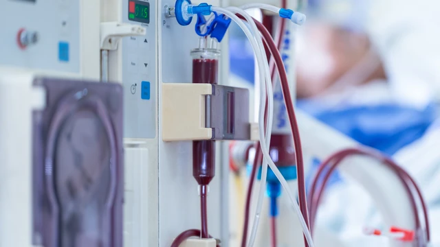 bai-viet/bao-dong-ca-benh-hiem-nu-sinh-17-tuoi-suy-da-tang-phoi-ngap-mau-10009.html