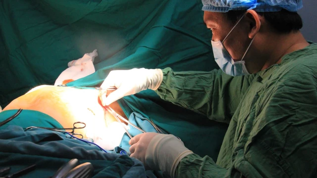 bai-viet/lom-nguc-co-phai-mo-khong-60366.html