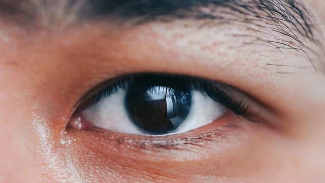 bai-viet/long-den-mat-goi-la-gi-van-de-thuong-gap-voi-long-den-mat.html