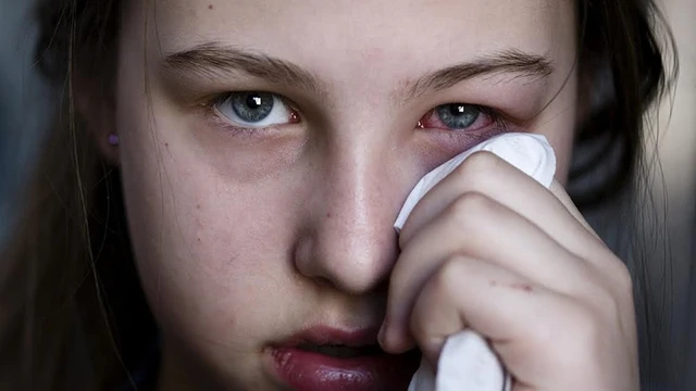 bai-viet/lupus-ban-do-anh-huong-den-mat-ban-nhu-the-nao-57483.html