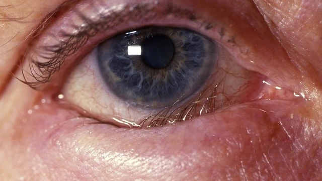 bai-viet/luu-lai-ngay-cach-chua-long-mi-quam-rat-hieu-qua-hien-nay.html