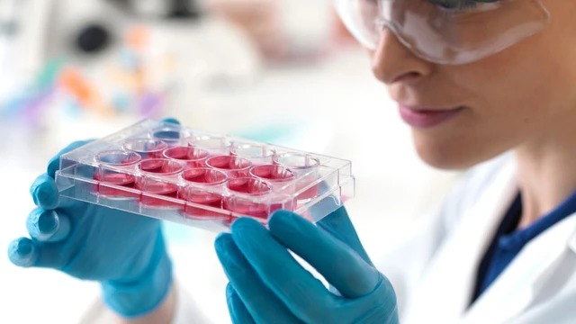 bai-viet/luu-tru-te-bao-goc-de-lam-gi-luu-y-gi-khi-thuc-hien.html