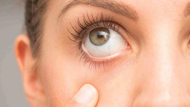 bai-viet/mach-ban-cach-don-giai-giup-cai-thien-tinh-trang-kho-moi-mat.html