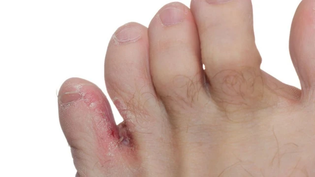 bai-viet/mach-ban-cach-tri-nuoc-an-chan-tai-nha-cuc-hieu-qua-69594.html