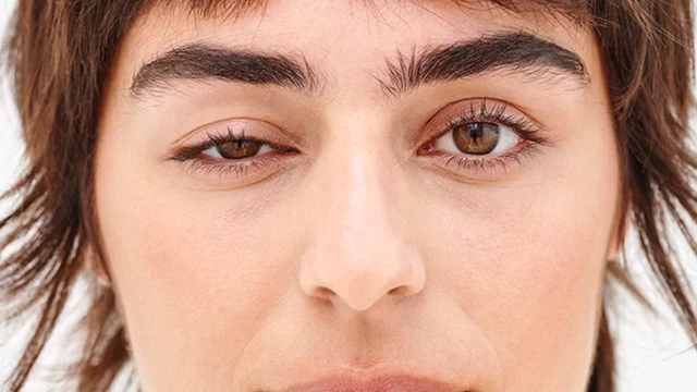 bai-viet/mat-bi-sup-mi-1-ben-phai-lam-sao-de-khac-phuc.html