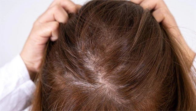 bai-viet/mat-do-toc-la-gi-mot-so-bien-phap-giup-cai-thien-mat-do-toc-tai-nha.html