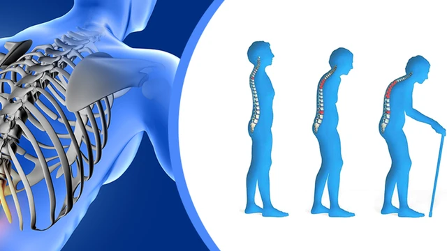 bai-viet/mat-do-xuong-bao-nhieu-la-bi-loang-xuong.html