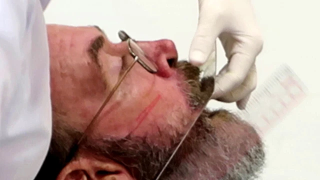 bai-viet/mat-phang-camper-va-mot-so-mat-phang-su-dung-pho-bien-trong-nha-khoa.html