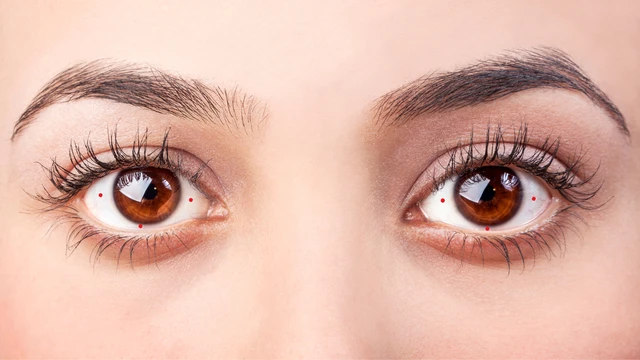 bai-viet/mat-tam-bach-la-gi-dau-hieu-nhan-biet-va-su-that-it-ai-biet.html