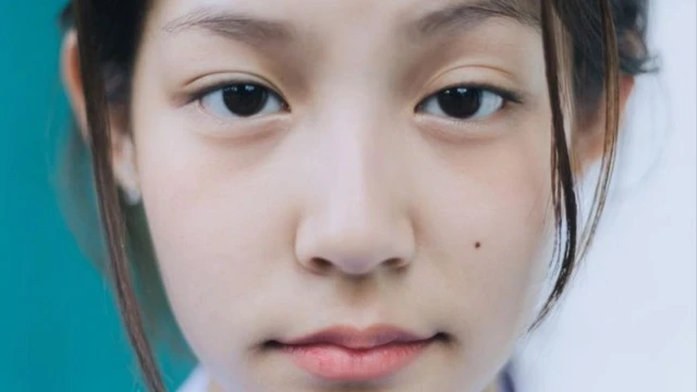 bai-viet/mat-vo-hon-la-gi-dau-hieu-canh-bao-suc-khoe-khong-nen-chu-quan.html