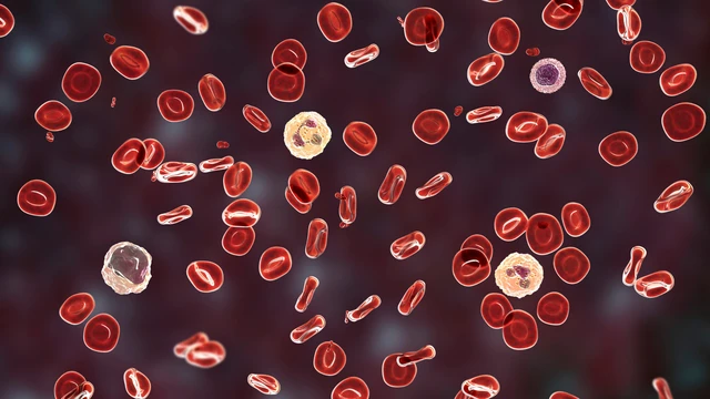 bai-viet/mau-mau-bi-vo-hong-cau-anh-huong-nhu-the-nao-den-ket-qua-xet-nghiem.html