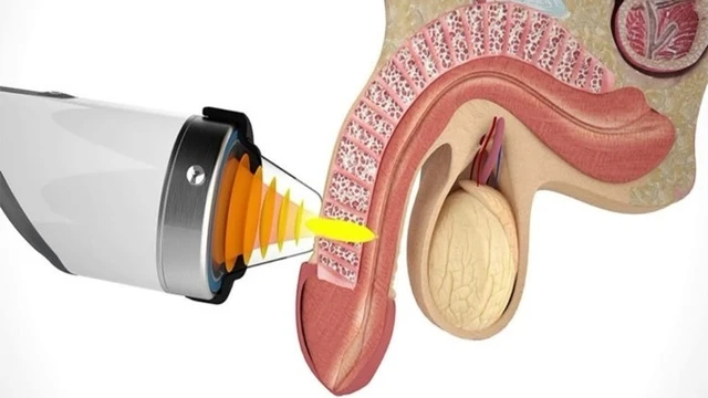 bai-viet/may-chua-roi-loan-cuong-duong-bang-song-xung-kich-co-hieu-qua-khong.html