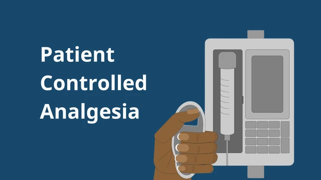 bai-viet/may-pca-giai-phap-giam-dau-hieu-qua-cho-benh-nhan.html