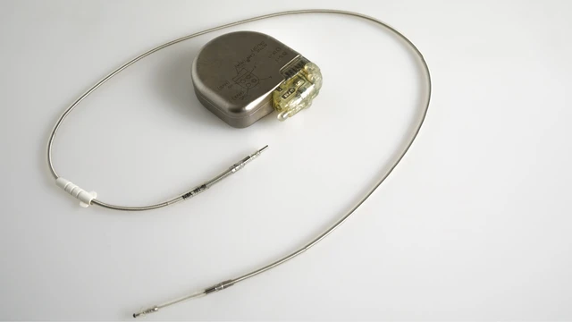 bai-viet/may-tao-nhip-tim-co-an-toan-khong.html