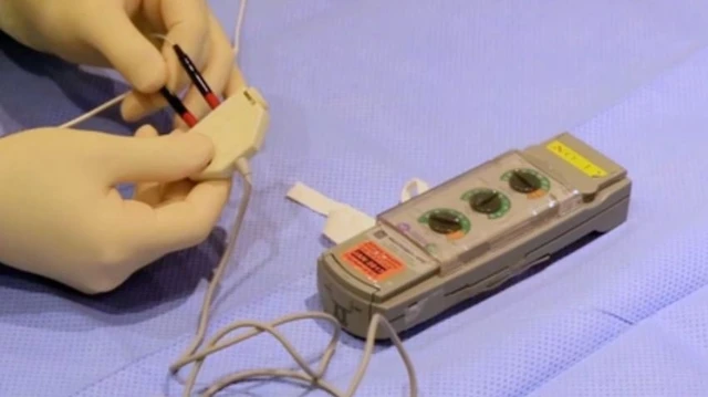 bai-viet/may-tao-nhip-tim-tam-thoi-giai-phap-ho-tro-nhip-tim-on-dinh.html