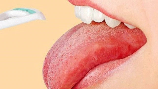 bai-viet/meo-chua-rat-luoi-don-gian-va-hieu-qua-tai-nha.html