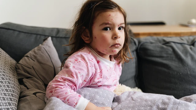 bai-viet/me-bi-thuy-dau-co-lay-nhiem-cho-be-khong-bien-phap-phong-ngua-lay-nhiem.html