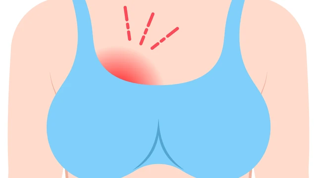 bai-viet/me-bim-bi-tac-tia-sua-uong-thuoc-gi-de-nhanh-khoi.html