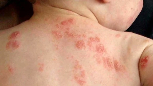 bai-viet/me-can-biet-be-bi-gioi-leo-phai-lam-sao.html