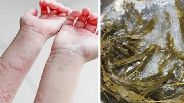 bai-viet/me-day-tam-la-khe-co-hieu-qua-khong-54811.html