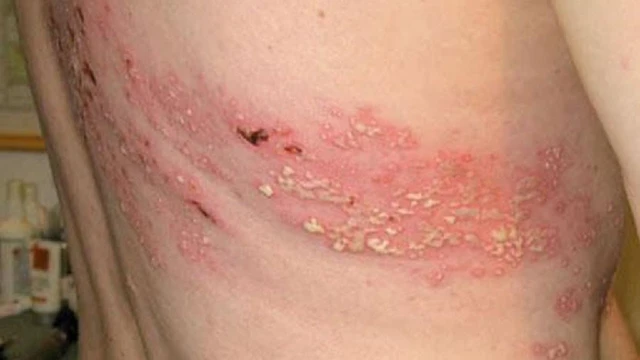 bai-viet/meo-dan-gian-chua-gioi-leo-bang-dau-xanh-cuc-nhanh-khoi-35897.html