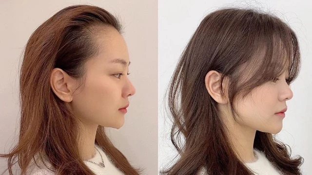 bai-viet/meo-khac-phuc-nhuoc-diem-toc-bo-liem-chi-voi-vai-thao-tac-70858.html