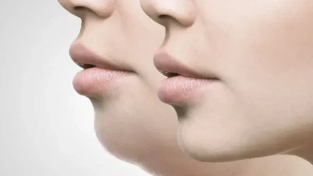 bai-viet/mewing-co-khac-phuc-cam-lem-nho-tap-luyen-moi-ngay-hay-khong-65158.html