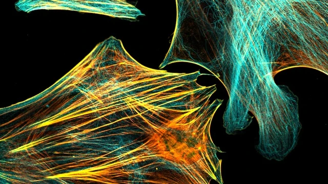 bai-viet/mien-dich-huynh-quang-la-gi-vi-tri-chan-doan-khi-thuc-hien.html