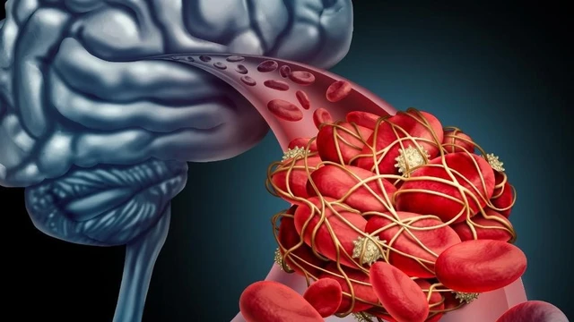 bai-viet/migrin-plus-tang-cuong-hoat-huyet-len-nao-cai-thien-chung-roi-loan-mat-ngu.html