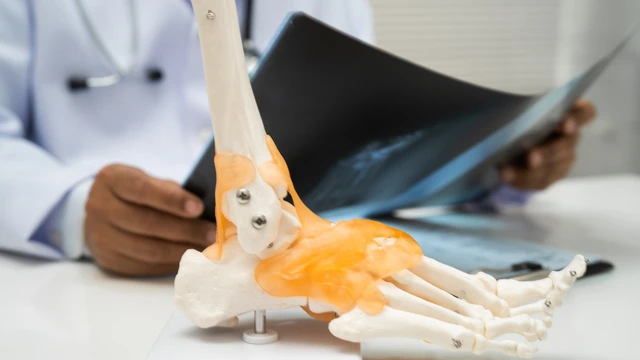 bai-viet/mo-mat-ca-chan-bao-lau-thi-khoi-thoi-gian-va-luu-y-sau-phau-thuat.html