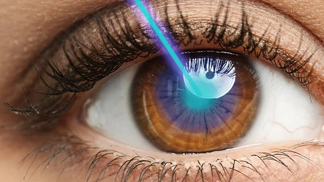 bai-viet/mo-mat-can-smile-pro-la-gi-co-nguy-hiem-khong.html