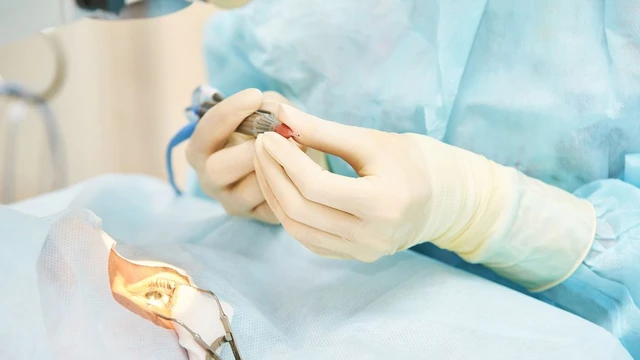 bai-viet/mo-phaco-bao-lau-lam-viec-binh-thuong-cach-giup-mat-nhanh-hoi-phuc.html