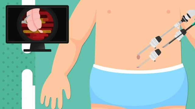 bai-viet/mo-ruot-thua-o-tre-em-bang-phuong-phap-nao.html