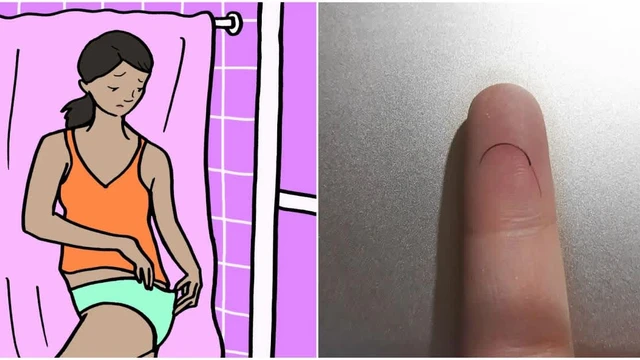 bai-viet/moc-long-o-hau-mon-co-sao-khong.html