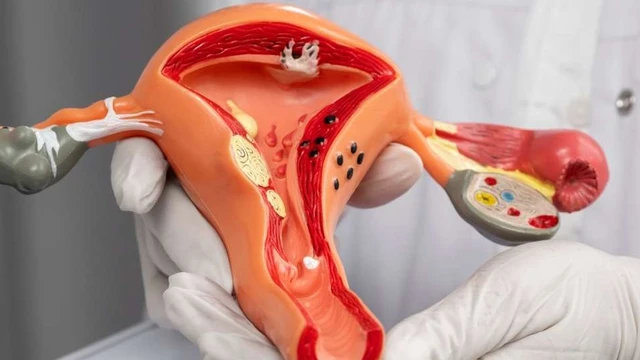 bai-viet/moi-lien-he-giua-u-xo-tu-cung-va-tao-bon-nhu-the-nao.html