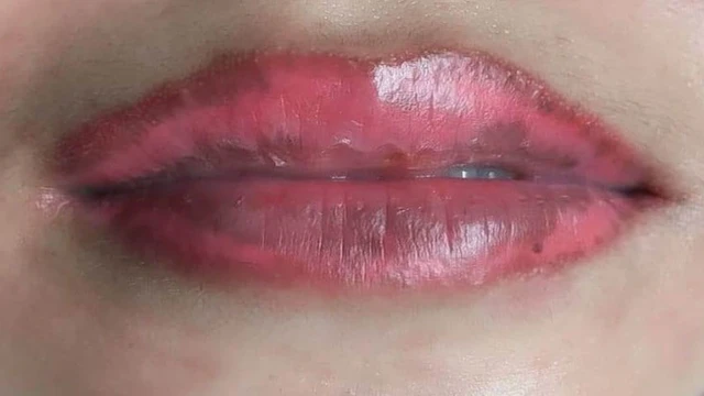 bai-viet/nguyen-nhan-moi-tham-loang-sau-phun-moi-va-cach-khac-phuc.html