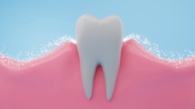 bai-viet/mon-men-rang-la-gi-nguyen-nhan-gay-mon-men-rang.html