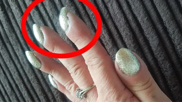 bai-viet/mong-tay-cong-xuong-la-dau-hieu-cua-benh-gi-trieu-chung-o-mong-tay-khong-nen-bo-qua.html