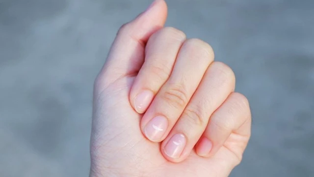 bai-viet/mong-tay-mau-trang-co-sao-khong.html