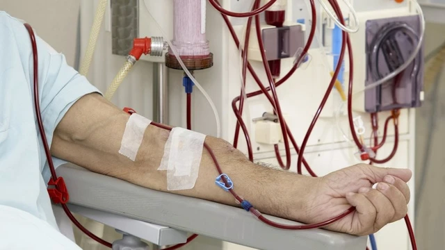 bai-viet/mot-lan-loc-mau-het-bao-nhieu-tien-cac-yeu-to-anh-huong-den-chi-phi-loc-mau.html