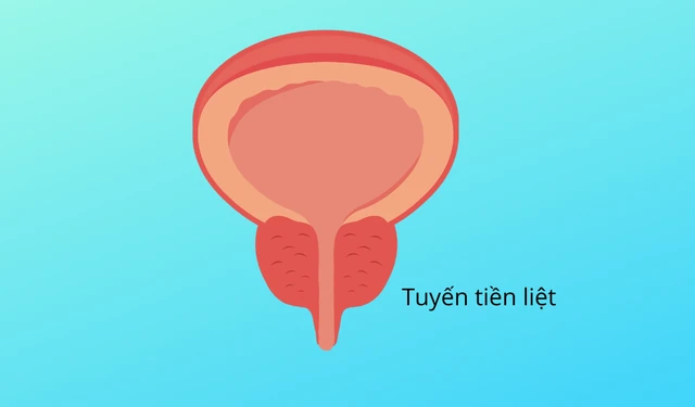 bai-viet/mot-so-bien-chung-u-xo-tien-liet-tuyen-ban-nen-biet-61993.html