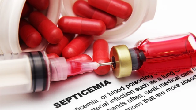 bai-viet/mot-so-dau-hieu-nhiem-trung-mau-ban-khong-nen-chu-quan.html