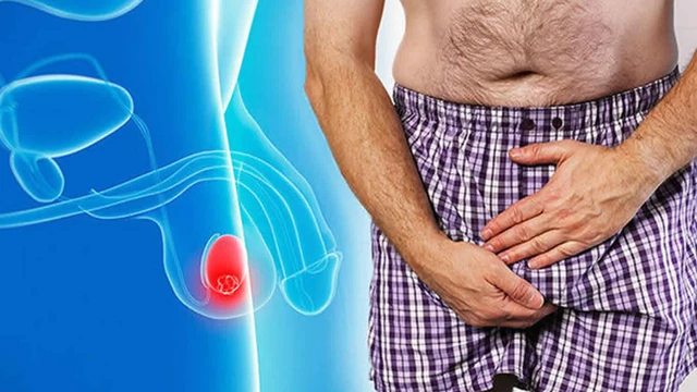 bai-viet/mot-tinh-hoan-co-cuc-nho-ran-khong-dau-co-the-la-bieu-hien-cua-benh-ly-nao.html