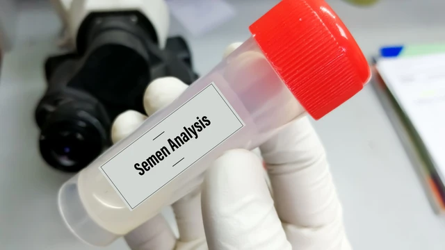 Tinh trùng có màu đỏ, hồng có sao không? Nguyên nhân và cách điều trị