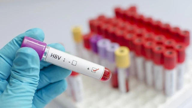 bai-viet/muc-dich-cua-dinh-luong-virus-viem-gan-b-la-gi.html