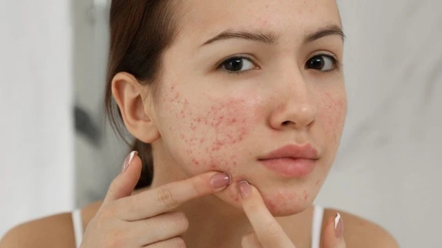 bai-viet/mun-boc-o-cam-la-gi-co-nguy-hiem-khong-co-nen-tu-nan-khong-67909.html